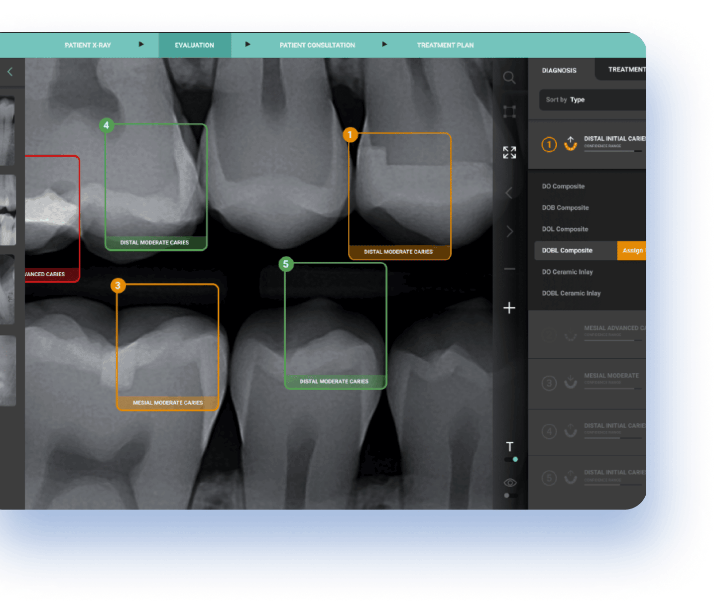 AI-Assisted Dental Diagnosis