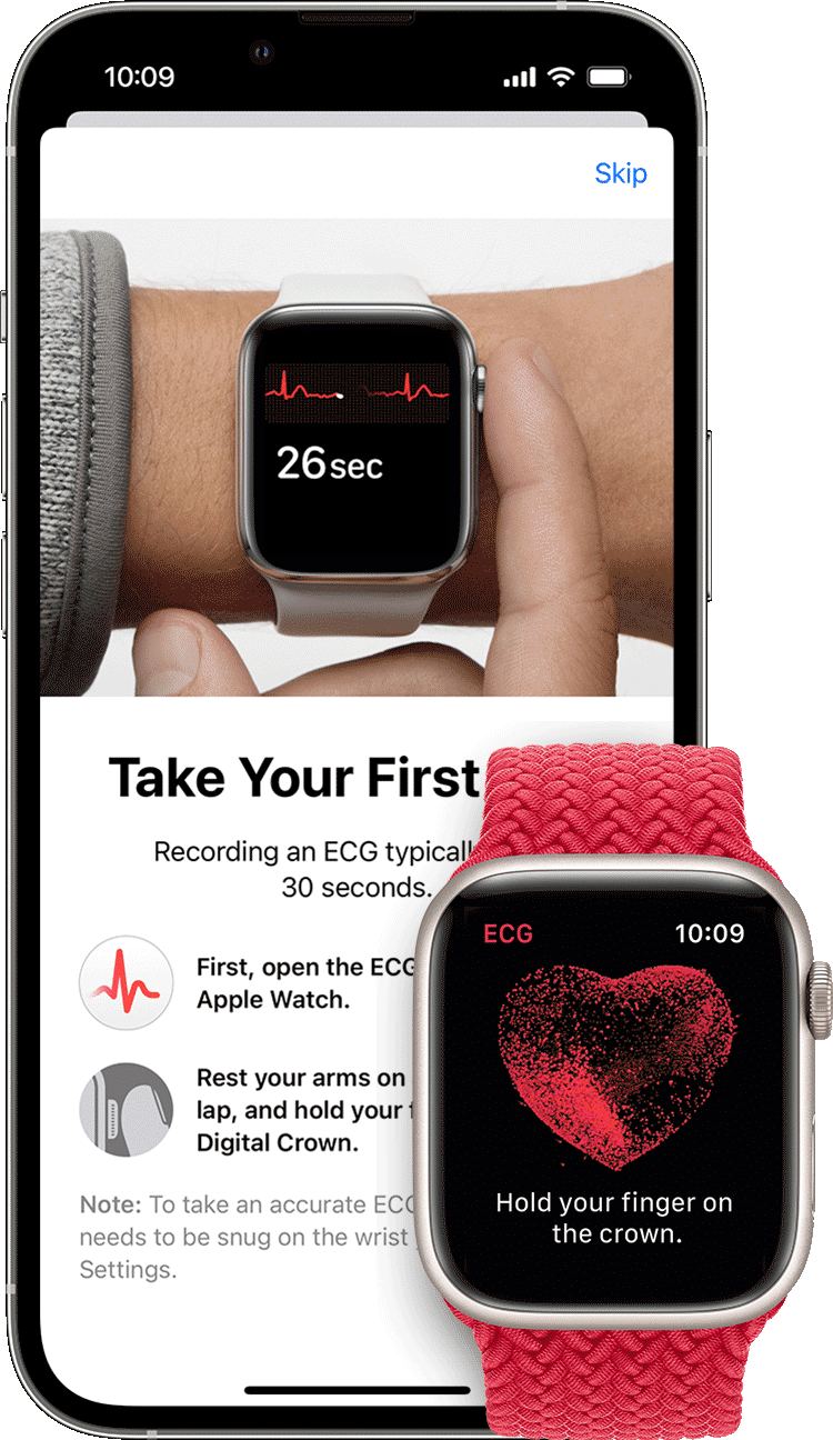The Mayo Clinic is applying AI to electrocardiogram (ECG) data captured by smartwatches.
